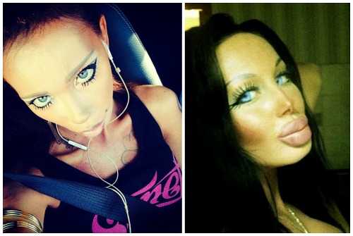 Пискун и все ее операции. биография