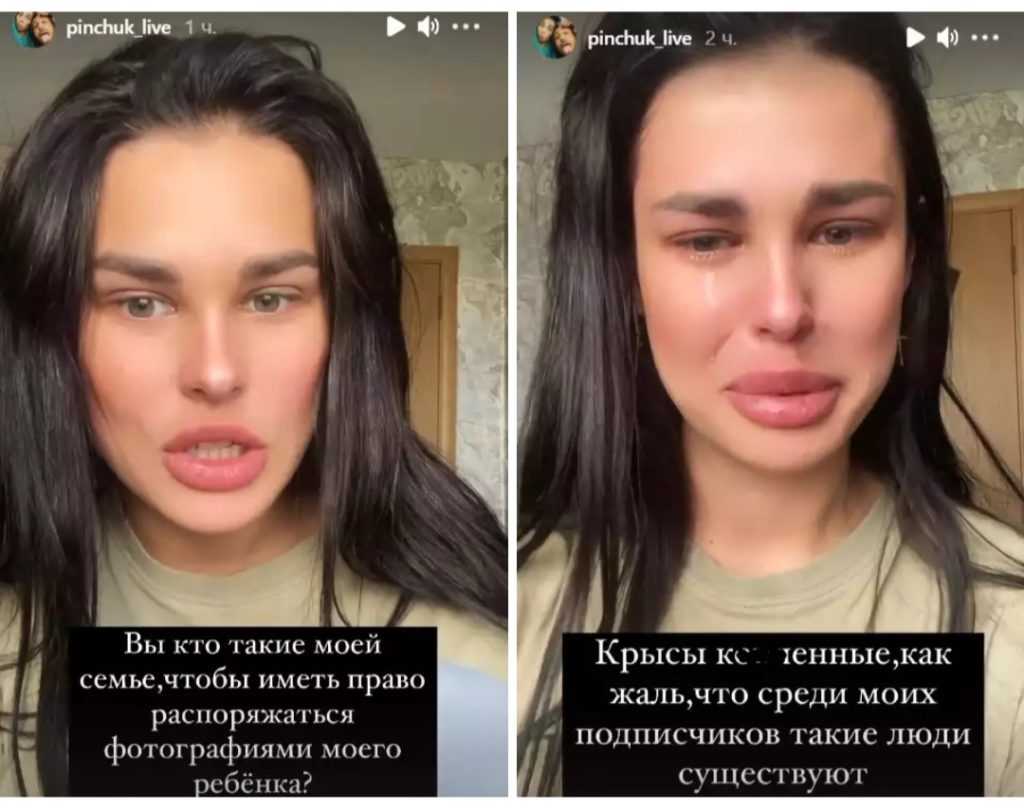 Ирина пинчук до и после пластики, фото, как выглядит сейчас 2022