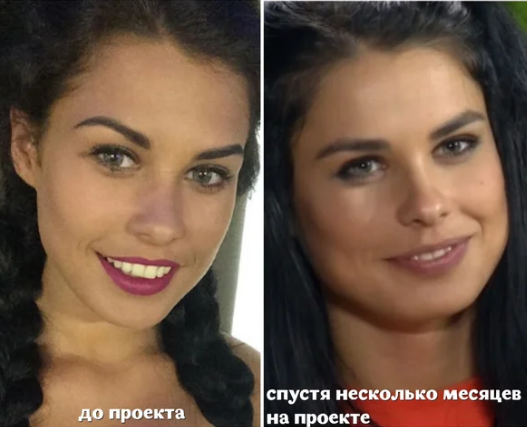 Ирина пинчук до и после пластики (фото)