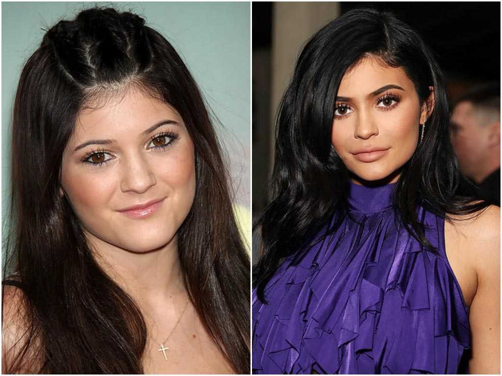 Kylie jenner: биография, параметры, горячие фото модели