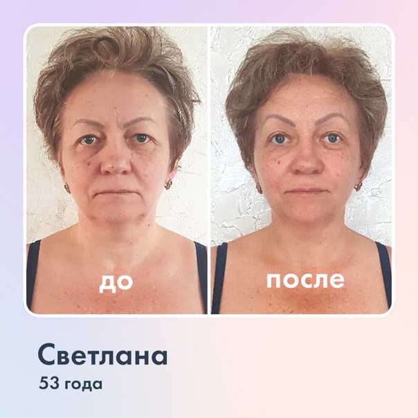 Ревитоника, упражнения для лица, шеи, исправления осанки, фитнес для омоложения