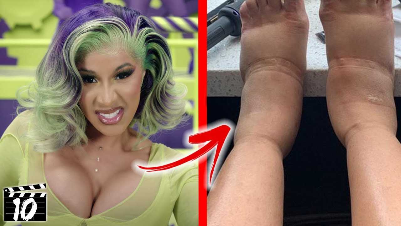 Cardi b plastic surgery revealed! (before & after photos 2021)