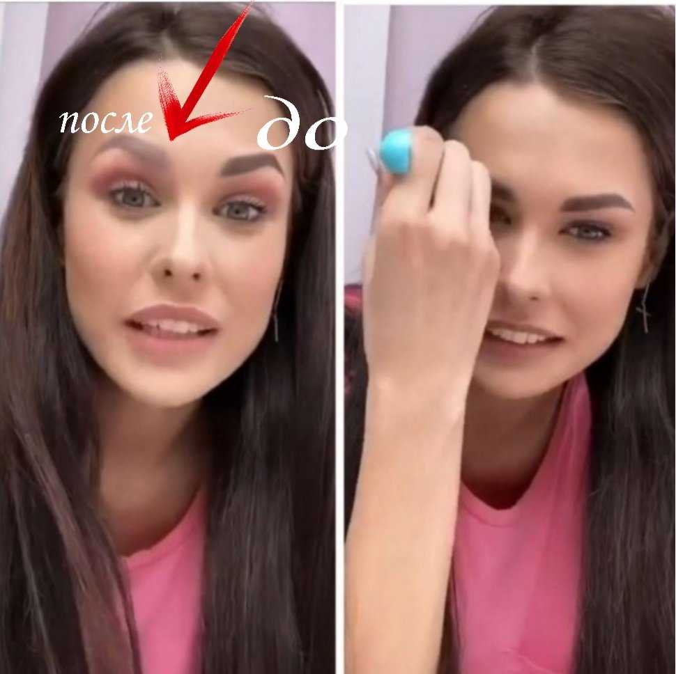 Пинчук до и после пластики +фото и биография — видео